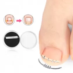 INF Korrektor für eingewachsene Zehennägel